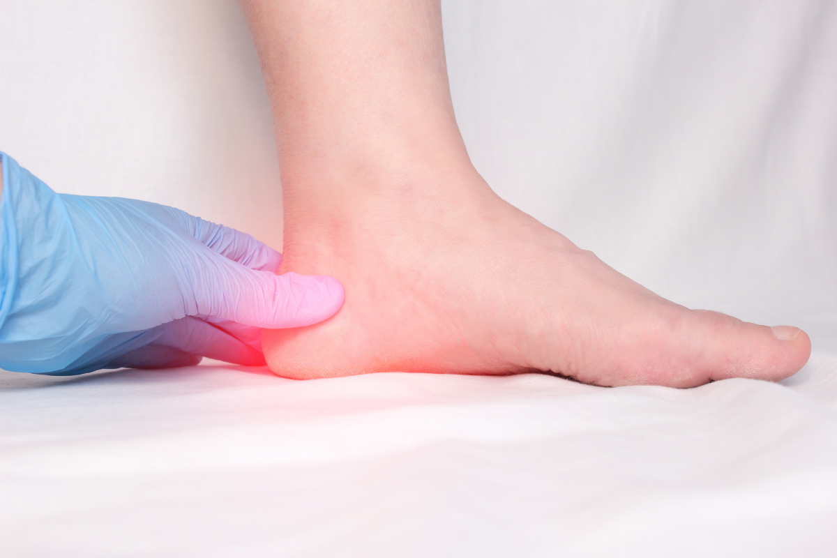 Symptoms of Plantar Fasciitis