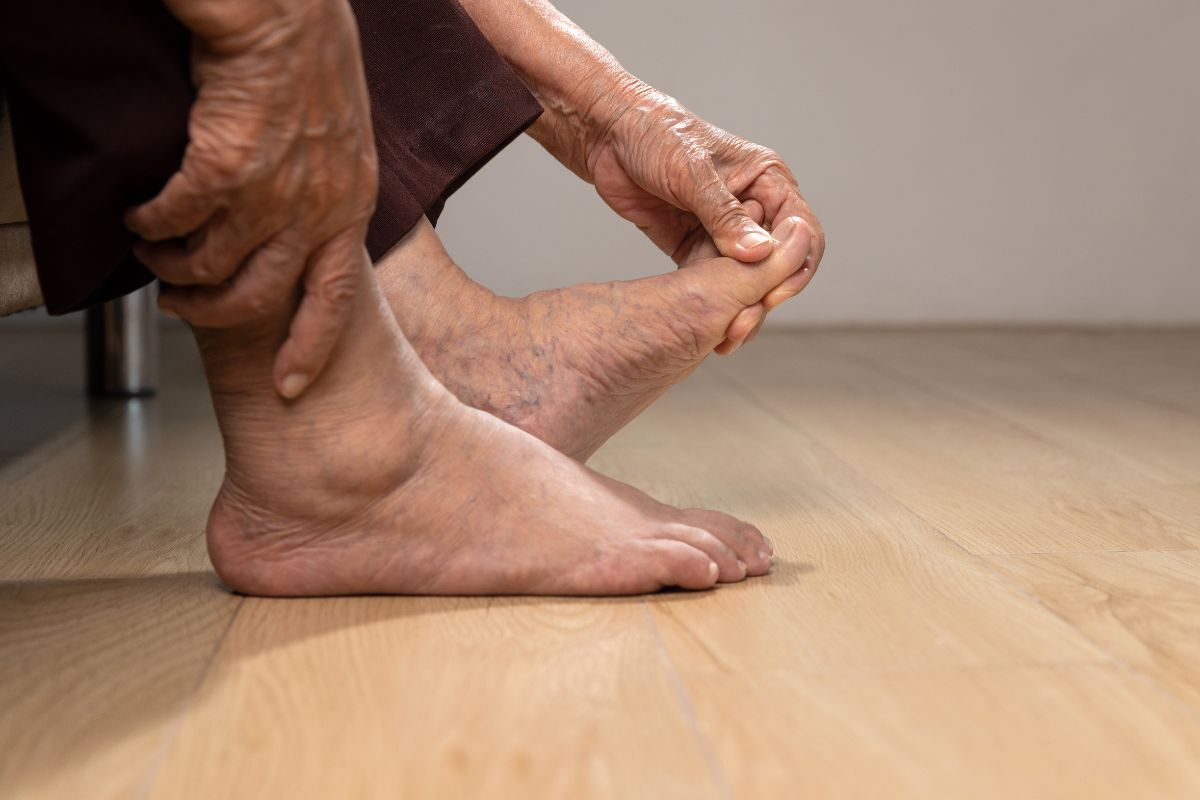 Foot Arthritis