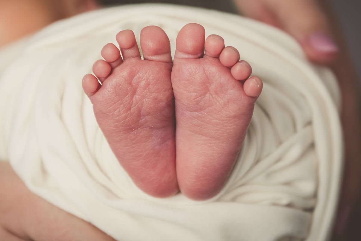 Flat Feet Baby Diagnosis