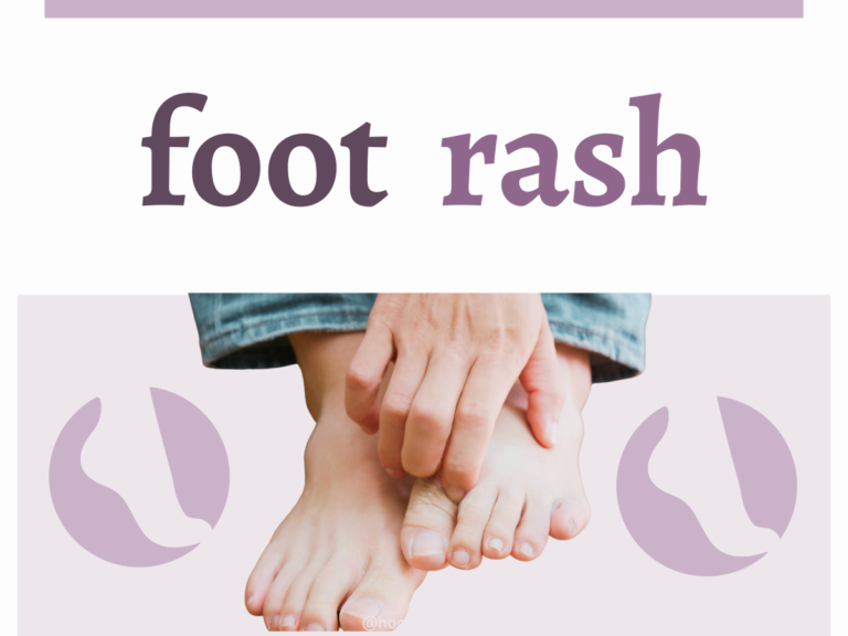 foot-rash-howard-county-foot-ankle